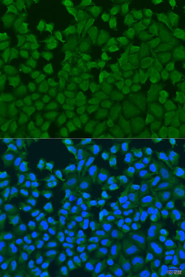 Anti-IL27RA Polyclonal Antibody (CAB8176)