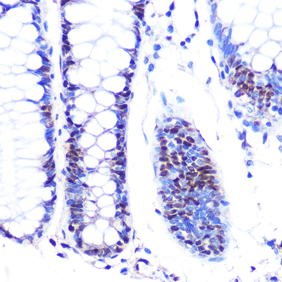 Anti-Ki67 Antibody (CAB16919)