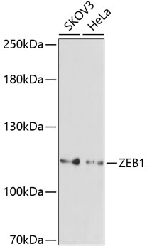Anti-ZEB1 Antibody (CAB5600)