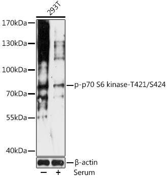 Anti-Phospho-P70S6K1-T421/S424 Antibody (CABP0540)