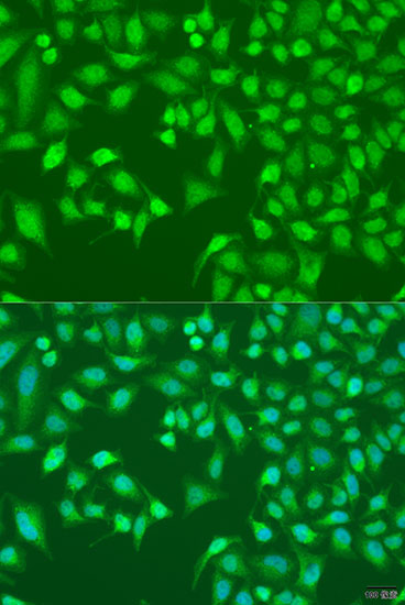 Anti-TRIM22 Antibody (CAB5508)