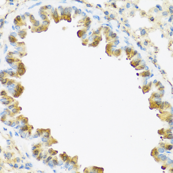 Anti-S100A7 Antibody (CAB1940)