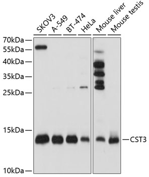 Anti-CST3 Antibody (CAB1561)