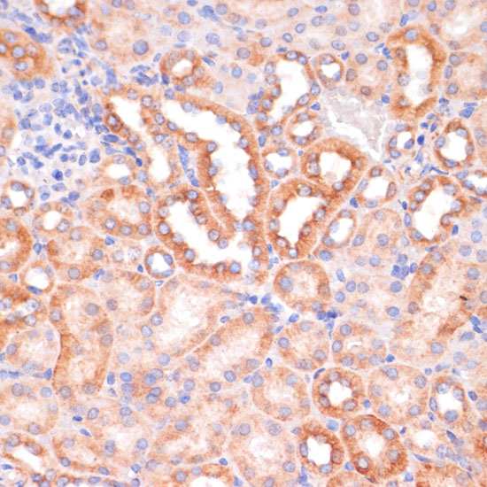 Anti-IKKAlpha Antibody (CAB2062)