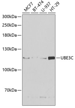 Anti-UBE3C Antibody (CAB6442)