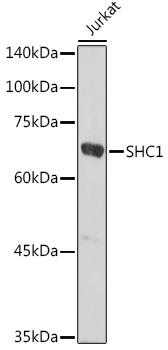 Anti-SHC1 Antibody (CAB7725)