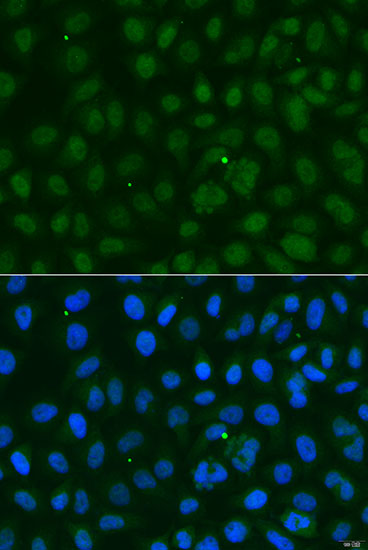 Anti-SUMO1 Antibody (CAB12529)