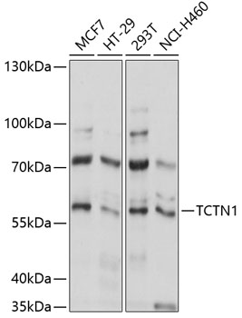 Anti-TCTN1 Antibody (CAB14928)