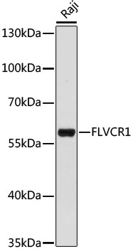 Anti-FLVCR1 Antibody (CAB15153)