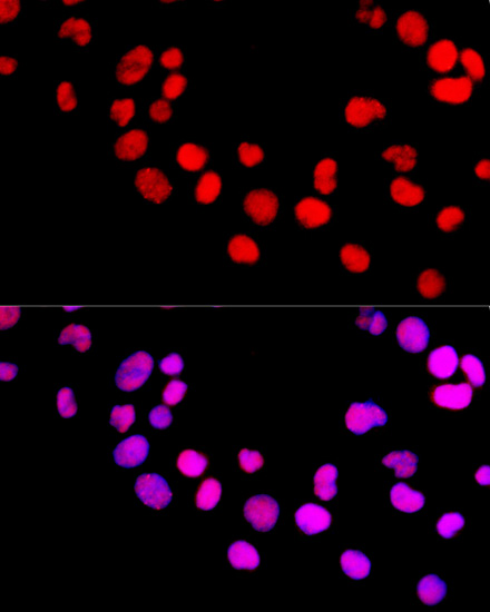 Anti-DNMT1 Antibody [KO Validated] (CAB5495)