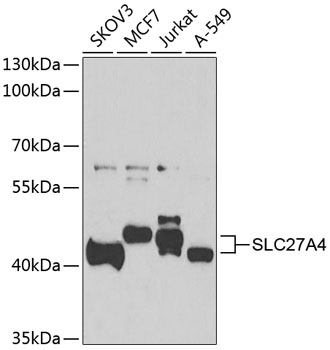 Anti-SLC27A4 Antibody (CAB7579)