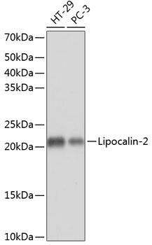 Anti-Lipocalin-2 Antibody