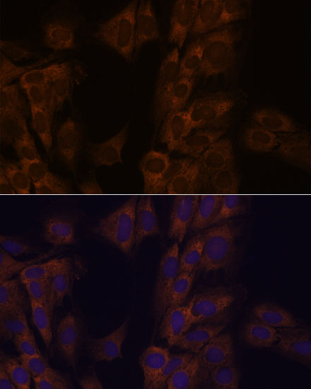 Anti-ATXN2 Antibody (CAB16666)