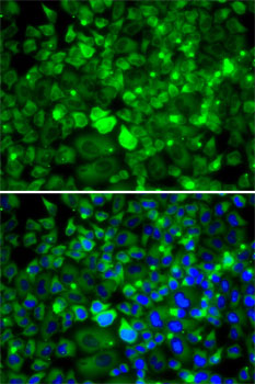 Anti-RPLP1 Antibody (CAB6725)