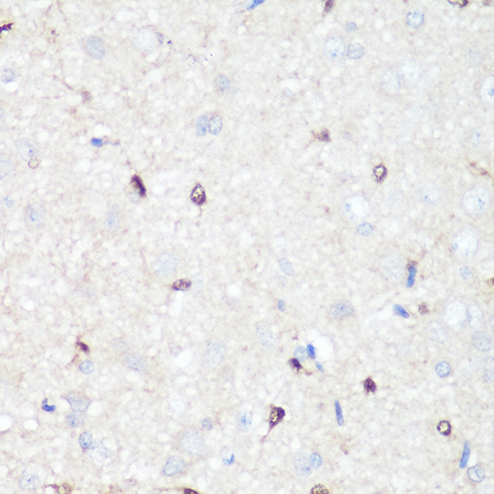 Anti-p38 MAPK Antibody (CAB10832)