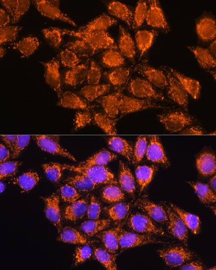 Anti-AMPD1 Antibody (CAB3584)