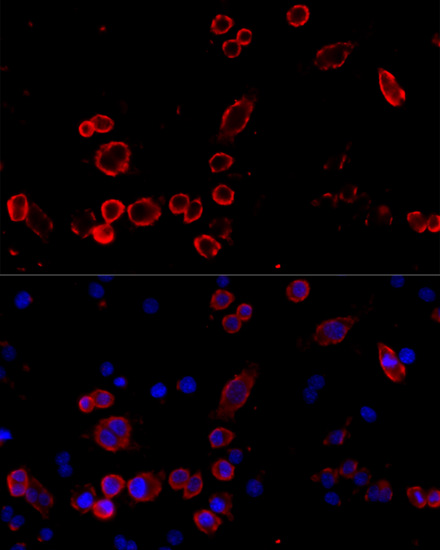 Anti-CD68 Antibody (CAB15037)