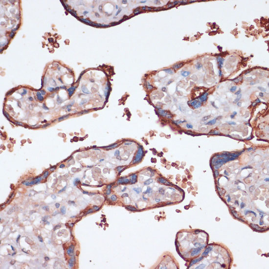 Anti-RPS6KA2 Antibody (CAB16305)