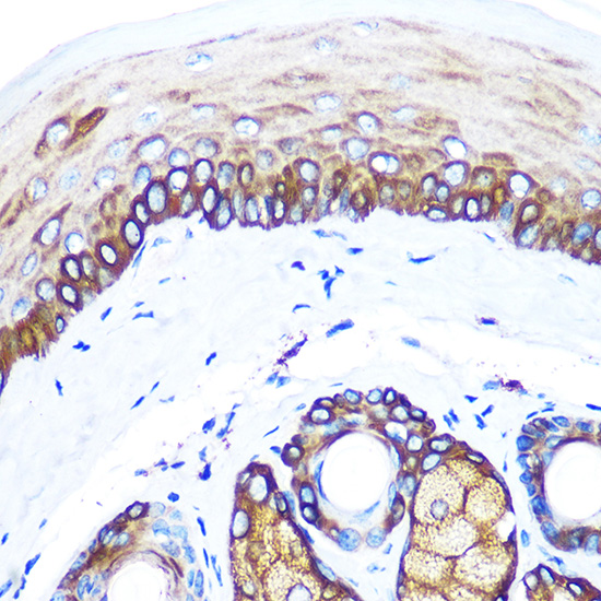 Anti-KRT14 Antibody (CAB15069)