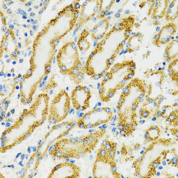 Anti-HSPA9 Antibody (CAB0558)