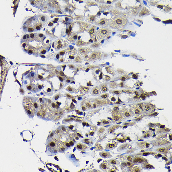 Anti-PTEN Antibody [KO Validated] (CAB11193)