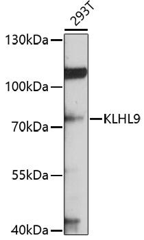 Anti-KLHL9 Antibody (CAB10149)