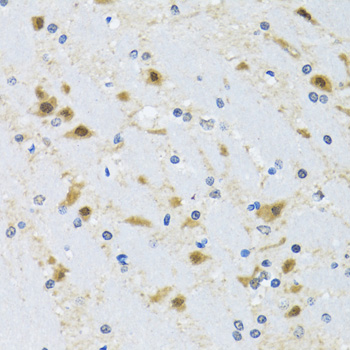 Anti-CCT4 Antibody (CAB6548)