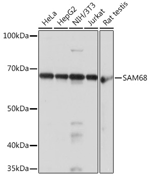 Anti-SAM68 Antibody (CAB3886)