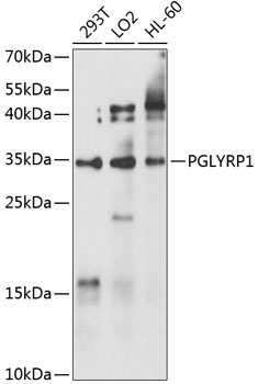 Anti-PGLYRP1 Antibody (CAB10460)