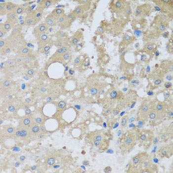 Anti-CHMP1B Polyclonal Antibody (CAB8239)