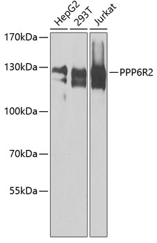 Anti-PPP6R2 Polyclonal Antibody (CAB8359)