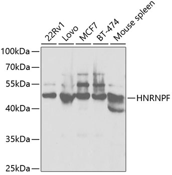 Anti-HNRNPF Antibody (CAB5505)