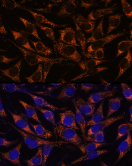 Anti-ACAA2 Antibody (CAB15778)