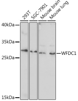 Anti-WFDC1 Antibody (CAB17193)