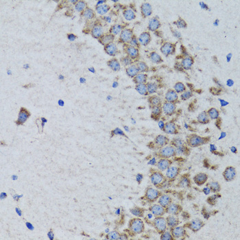 Anti-PTPN1 Antibody [KO Validated] (CAB1590)