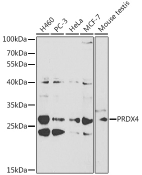 Anti-PRDX4 Antibody [KO Validated] (CAB1486)