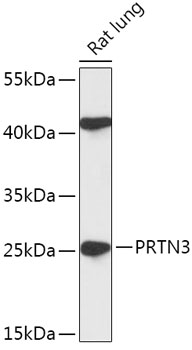 Anti-PRTN3 Antibody (CAB17522)