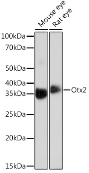 Anti-Otx2 Antibody (CAB4351)