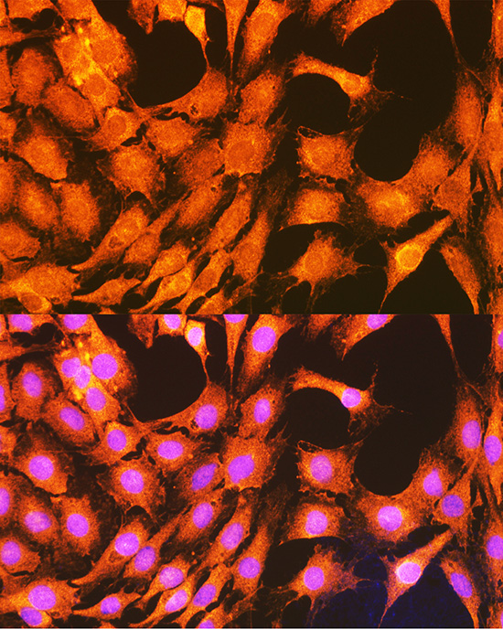 Anti-PHKG2 Antibody (CAB7337)