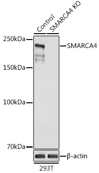 Anti-SMARCA4 Antibody [KO Validated] (CAB2117)