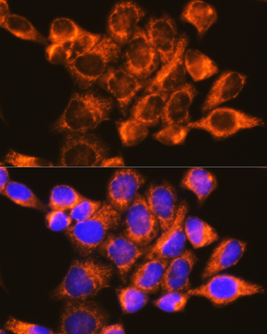 Anti-EIF4G2 Antibody (CAB2897)