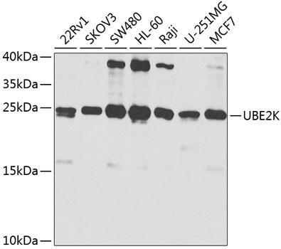 Anti-UBE2K Antibody (CAB1086)