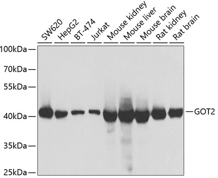 Anti-GOT2 Antibody (CAB6915)