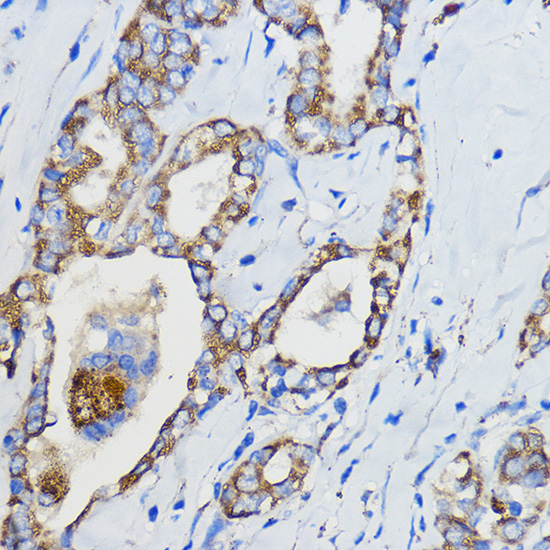 Anti-CYP51A1 Antibody (CAB13485)