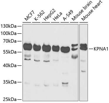 Anti-KPNA1 Antibody (CAB13623)