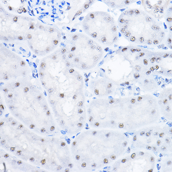 Anti-SMEK1 Polyclonal Antibody (CAB8500)