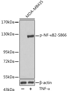 Anti-Phospho-NFKB2-S866 Antibody (CABP0418)