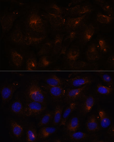 Anti-ESYT1 Antibody (CAB15410)