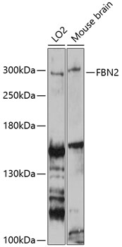 Anti-FBN2 Polyclonal Antibody (CAB9414)