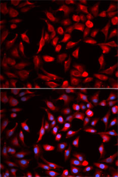 Anti-CBR1 Antibody (CAB5446)